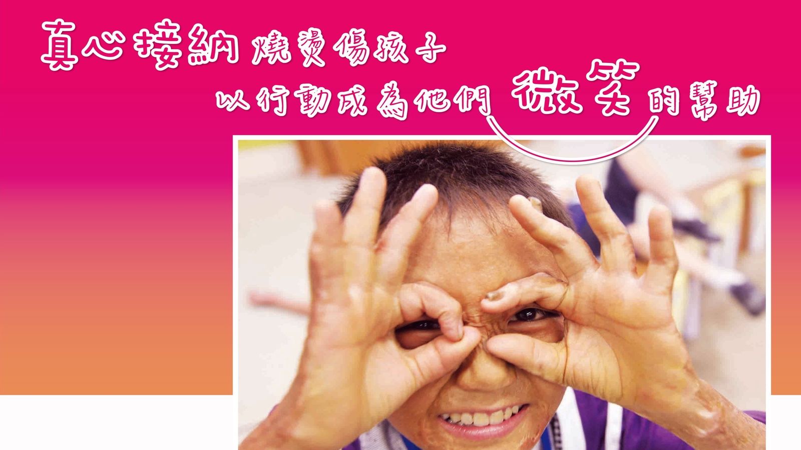 中華民國兒童燙傷基金會活動圖片1