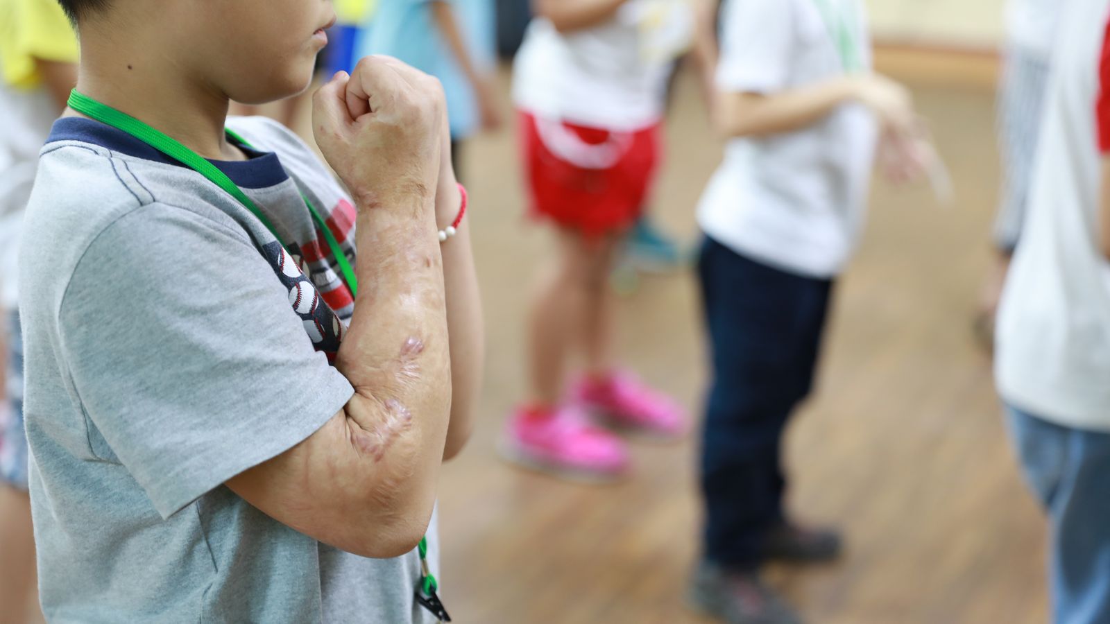 中華民國兒童燙傷基金會活動圖片2